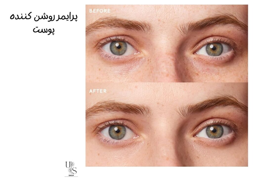 انواع پرایمر چشم